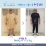 위밴드수술 8개월 후 46.7kg 감량 전후사진