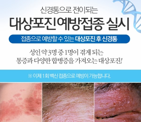 성인 3명중 1명이 겪는대상포진 알고 계세요? : 네이버 블로그