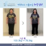 위밴드수술 1년후 25kg 감량 전후사진
