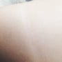 미백크림 ) 블랙샷플러스 2주 사용 경과 (팔꿈치 색소침착,겟잇뷰티 미백크림)