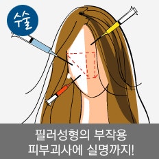 안전성, 솔직하게 따져볼게요 — 코필러 혈관 리스크 vs 코수술 재수술률 현실