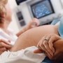 임산부 초음파 사진 보는 방법에 대해서 알아볼까요?