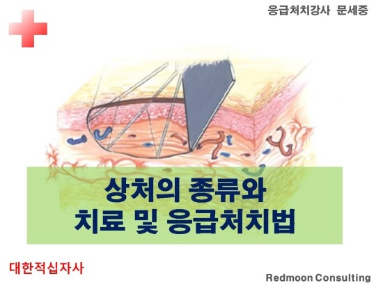 [광주응급처치교육] 상처의종류와 상처치료 및 응급처치법을 봅시다! : 네이버 블로그