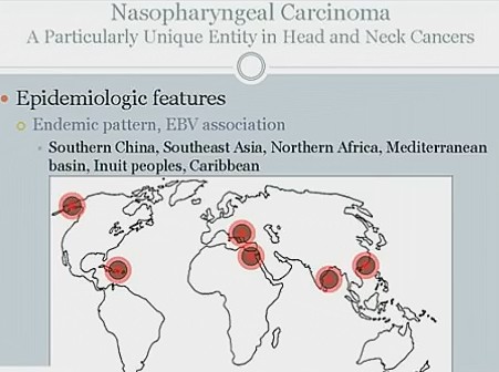nasopharyngeal carcinoma (NPC) : 네이버 블로그