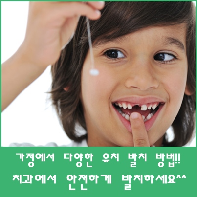 가정에서 다양한 유치 발치 방법!! 치과에서 안전하게 발치하세요^^ : 네이버 블로그