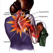 견갑늑골 증후군 (Scapulocostal syndrome) - 어깨통증원인 [분당체형교정/재활운동/어깨통증/골프트레이닝]