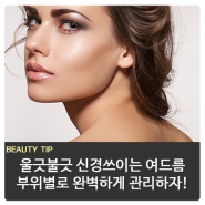 여드름 부위별 원인과 해결방법!