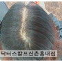 신촌여성탈모관리후기,홍대여성탈모관리후기 입니다.