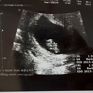 한번에 몰아쓴는 태교일기 ㅋ 임신 9주~임신 26주