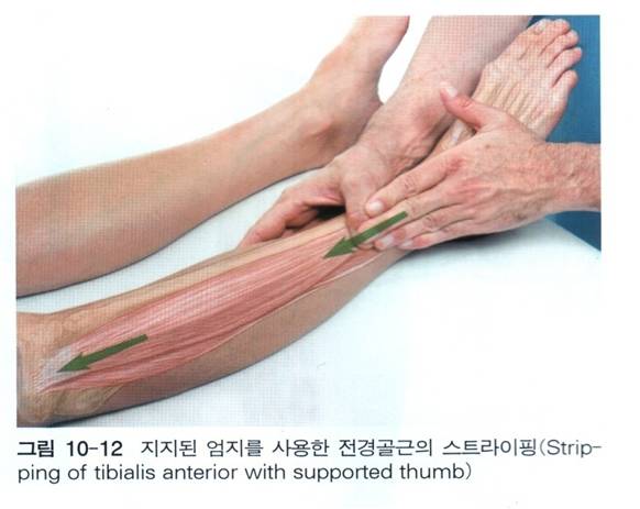 근육골격계 마사지,IASTM,Soft Tissue Mobilization Technique(연부조직가동술),KSTM,STM크림 ...
