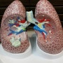 COPD 호흡기 질환의 종착역