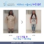 위밴드수술 1년 5개월 후 71.7kg 감량 전후사진