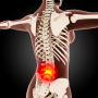 척추 바로잡기2-'척주관협착증' 운동요법
