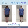 위밴드수술 1년 후 39kg 감량 전후사진