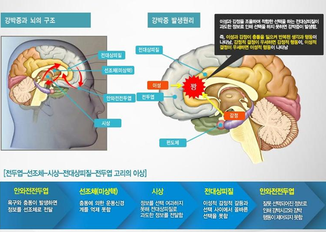 강박증치료방법 머리가 복잡해요 : 네이버 블로그