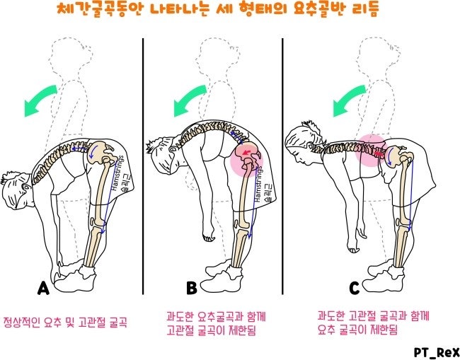 [해운대/센텀/체형교정/바른자세]우리 몸의 대들보 허리!! 움직임을 정확하게 아는 것이 척추건강을 지키는 길입니다 ...