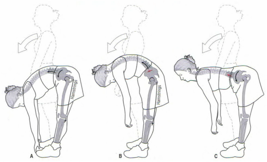 Lumbar pelvic rhythm 요추 골반 움직임 검사 : 네이버 블로그