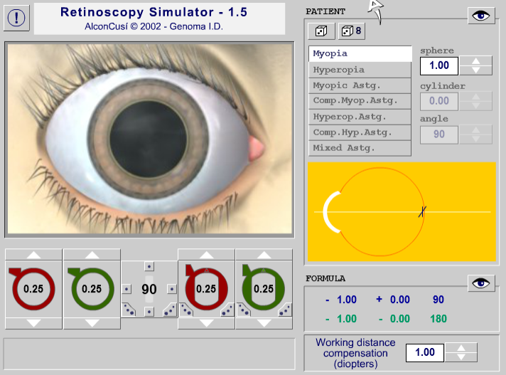 Retinoscopy simulator 입니다 연습해보세요 네이버 블로그