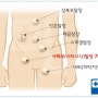 탈장의 정의와 증상에 대해 알아봅시다.