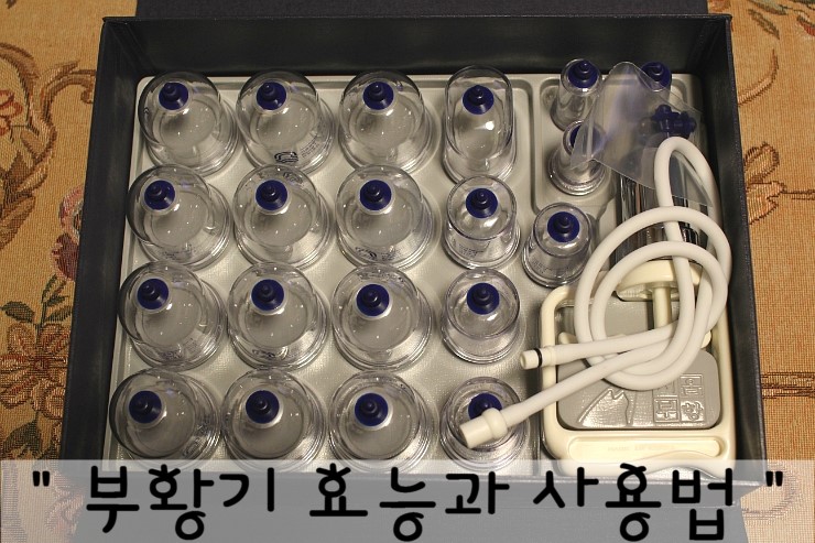 [서울부항] 부황 효능 혈액순환 어깨결림완화 : 네이버 블로그