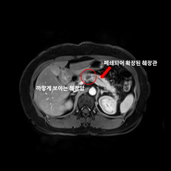ì·Œìž¥ì•