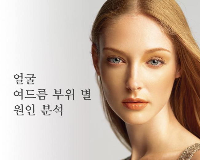 [피부] 얼굴 부위별 여드름 원인과 해결 : 네이버 블로그