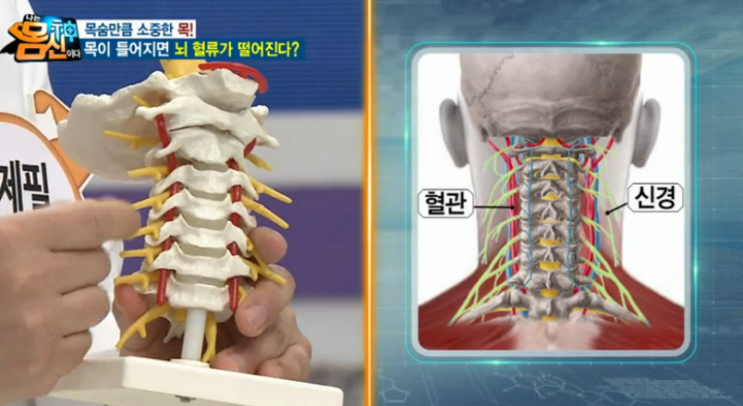 소중한 목, 당신의 목은 건강합니까? : 네이버 블로그