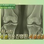닥터지.바.고 <채널A : 골든병 중년 여성의 뼈건강을 지켜라!>