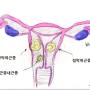 자궁근종(Myoma Of the Uterus), 호원동한의원 의정부 한의학적 접근법^^