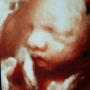 임신 28주 초음파사진 :: 입체사진 이제 제법 신생아 얼굴처럼 보여요