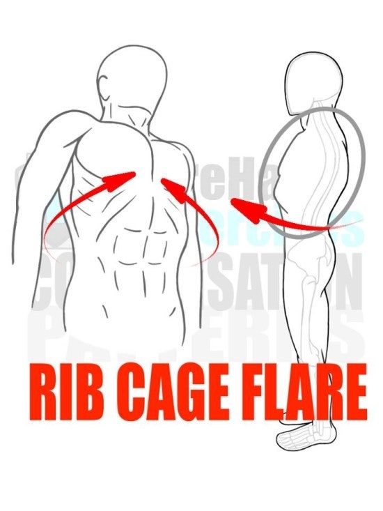 Prehab Ex - Flared Rib Cage : 네이버 블로그