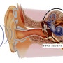 [난청 이야기] 감각신경성 난청