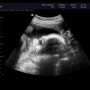 임신 32주 초음파사진 :: 병원진료 후 만삭촬영 다녀왔어요