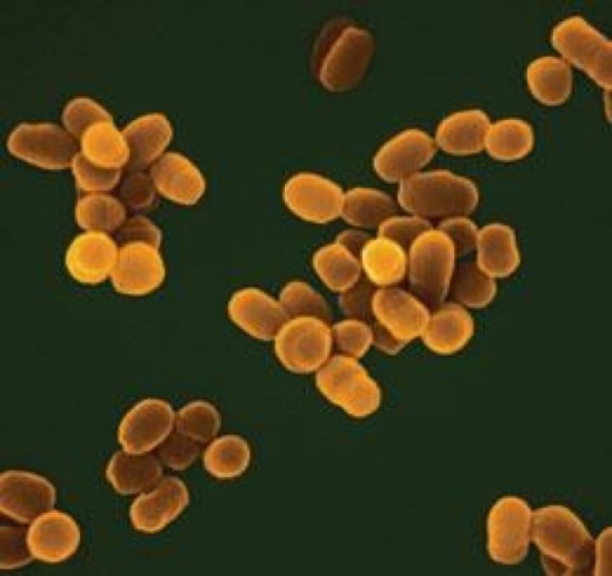 브루셀라증(Brucellosis) 임상증상, 진단, 치료 : 네이버 블로그