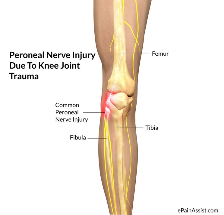 common-peroneal-nerve-history-and