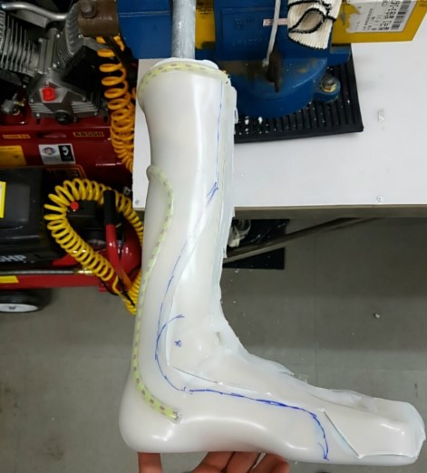 Posterior leaf spring AFO ( PLS AFO, PLSO ) 발끌림, 플라스틱 맞춤형 발목 관절 보조기, 발목 ...