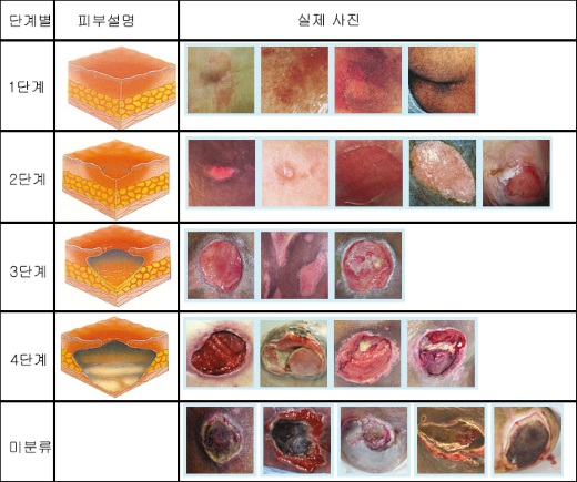 [간호과정] 의식 저하와 관련된 피부 손상 위험성(ICH) : 네이버 블로그