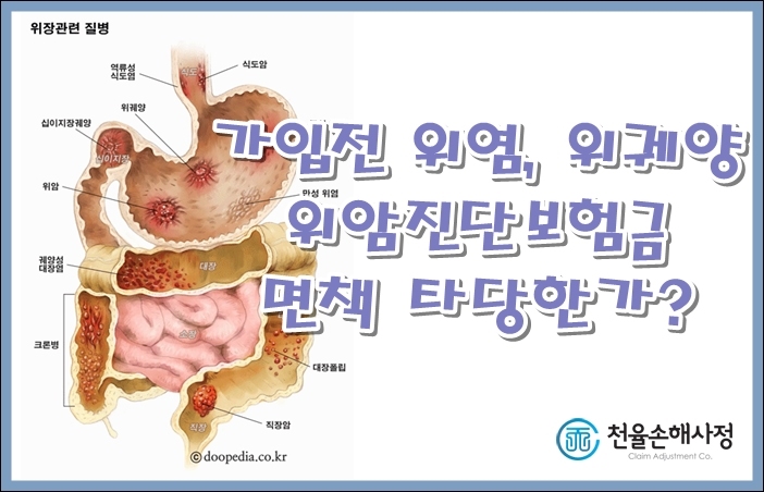[위암] 위염, 위궤양 고지의무 위반 위암 보험금 손해사정 : 네이버 블로그