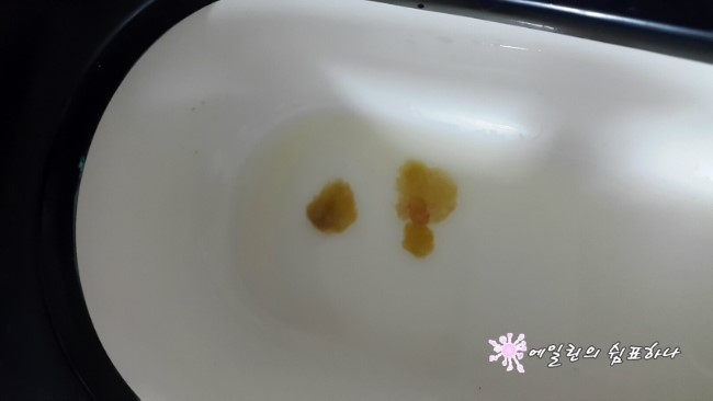 장염 증상 및 빨리낫는법 :: 점액변 본다ㅠ : 네이버 블로그