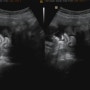 임신 36주 : 막달진입, 막달에 알아두어야 할 사항