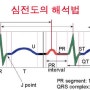 [인천힘찬병원] 심장질환을 알수있는 심전도 검사 2편