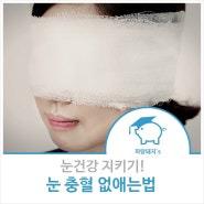 눈 충혈 없애는법 어렵지 않아요.