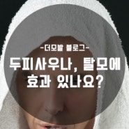 두피사우나 탈모에 효과가 있나요?