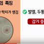 가을철 쯔쯔가무시병 조심하세요