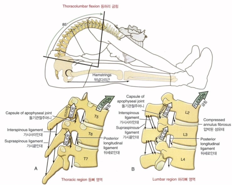 흉추 굴곡 증후군/등뼈 굽힘 증후군(thoracic flexion syndrome) : 네이버 블로그
