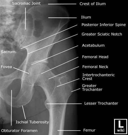 Hip X-ray의 Systemic approach : 네이버 블로그