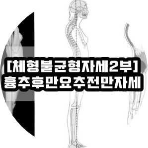 [체형불균형]흉추후만 & 요추전만자세를 위한 운동법 : 네이버 블로그