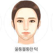 [보톡스] 사각턱 보톡스는 얼마나 유지될까?