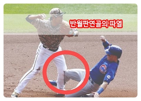 맥머레이 테스트(McMurray test) = 무릎반달연골테스트 : 네이버 블로그