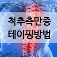 허리통증테이핑방법 / 척추 옆굽음증, 척추측만증 테이핑